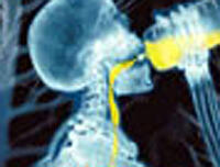 A scene from "The Human Body."
