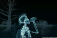 X-ray of Luke's profile in "The Human Body."
