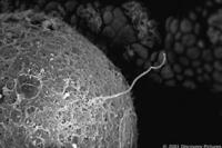 Sperm penetrating the egg in "The Human Body."