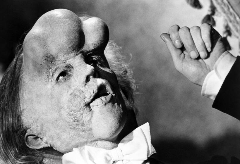 
	The Elephant Man
