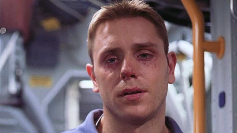 Don't Let THIS Happen to Your Eyes…