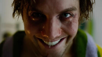 Smile 2